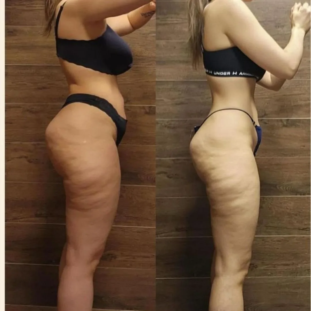 Before and after — Ashley