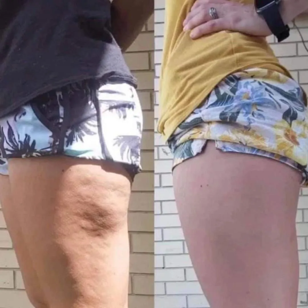 Before and after — Brittany