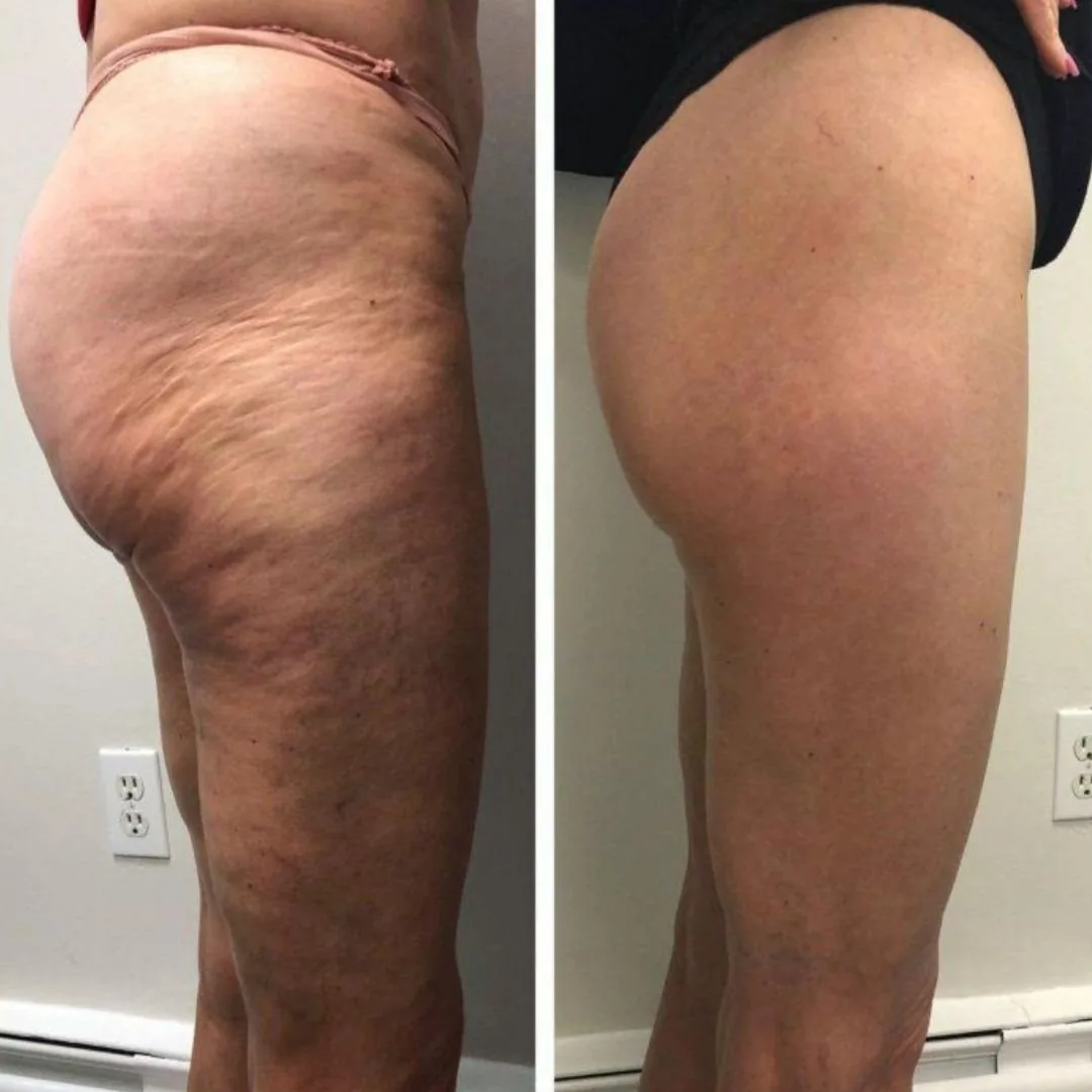 Before and after — Megan