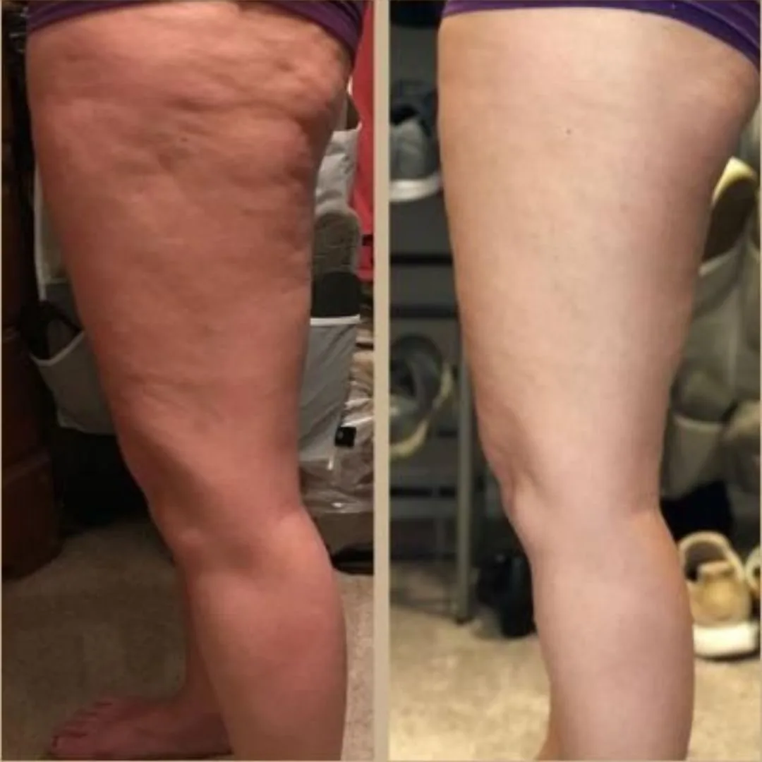 Before and after — Nicole