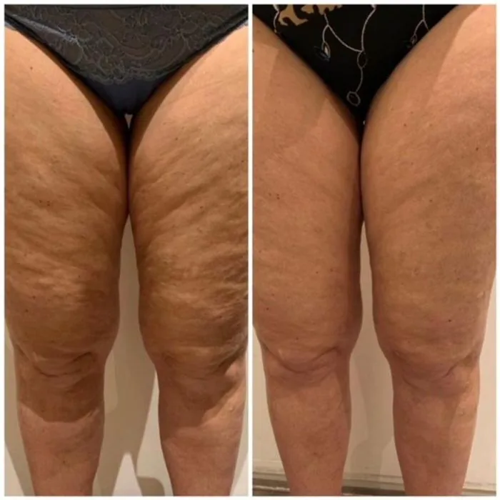 Verified customer photo
