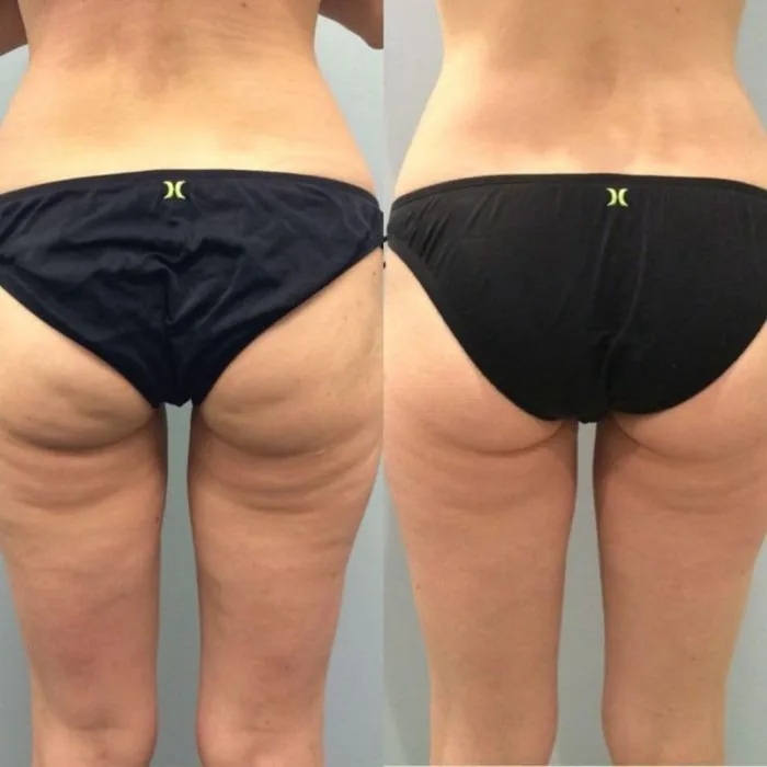 Verified customer photo