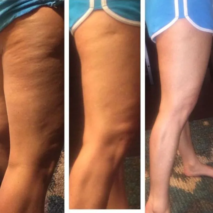 Verified customer photo