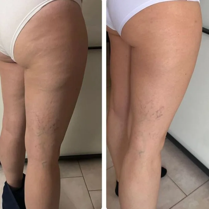 Verified customer photo